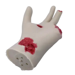 White silicone hand model with red wound simulations on fingers and palm for medical training