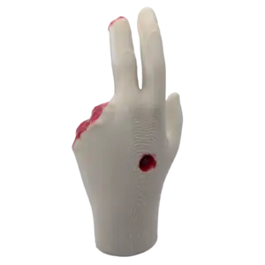 White prosthetic hand model standing upright with red wound marks on the index finger tip and wrist against a black background